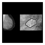 Hologic Understanding ImageChecker CAD 10.0 Mode d'emploi