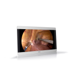 MDSC-8231 &Eacute;cran Chirurgical: Chat IA + PDF Manuel