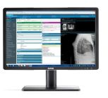 Barco MDRC-2224 Option WP Mode d'emploi | Fixfr