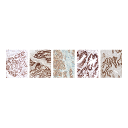 Staining Colorectal Tissue for VENTANA MMR IHC Panel (OUS)