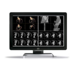 Coronis Fusion MDCC-4330/6430 | Guide de l'utilisateur + IA