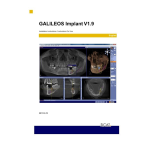 Dentsply Sirona GALILEOS Implant Version 1.9.2 Mode d'emploi