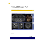 GALILEOS Implant 1.9.2: Notice d'utilisation + IA Chat