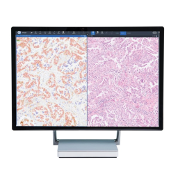 uPath PD-L1 image analysis for NSCLC IVD Algorithm