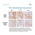 Roche VENTANA PD-L1 (SP142) Assay Manuel utilisateur